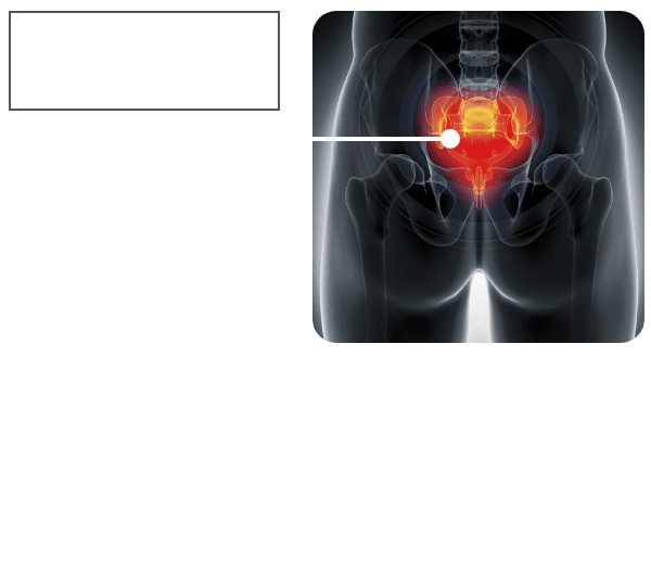 仙骨を刺激し腰部を温める、業界初のEBS（Electrical Bone Stimulation）