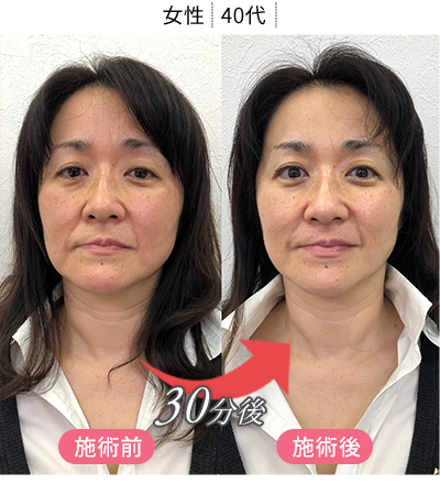 体験者の変化