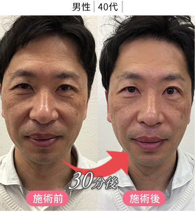 体験者の変化