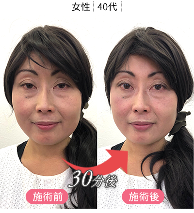 体験者の変化