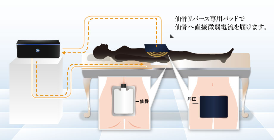仙骨リバースのしくみ